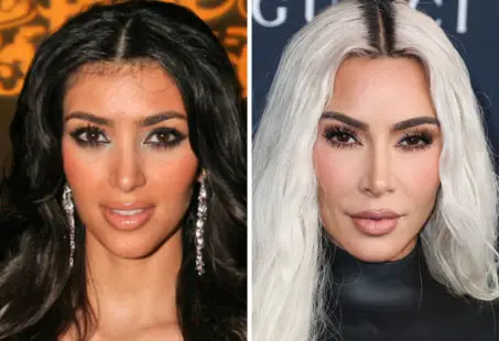 kim kardashian before after