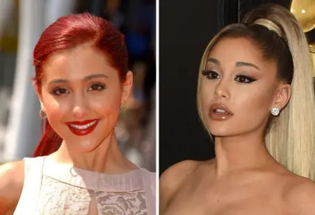 ariana grande plastic surgery