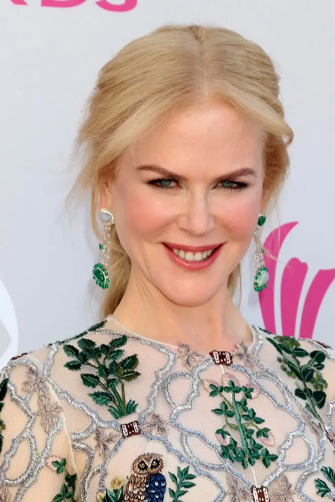 nicole kidman botox