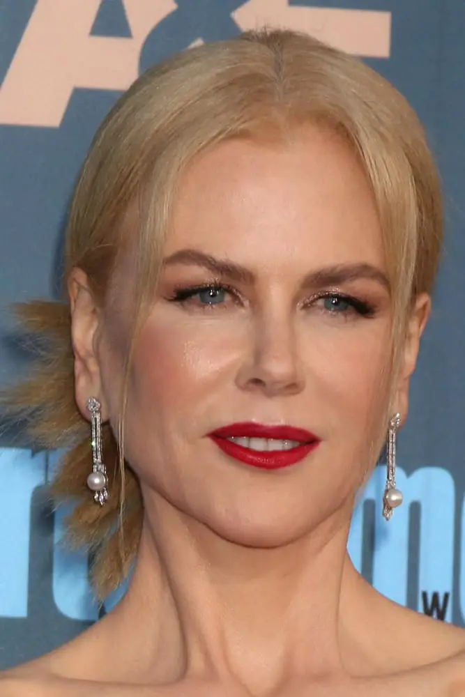 nicole kidman filler