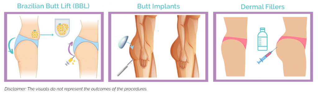 BBL Butt Implant Filler