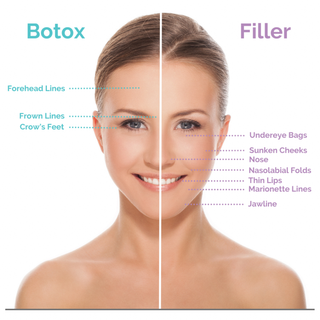 Botox Filler