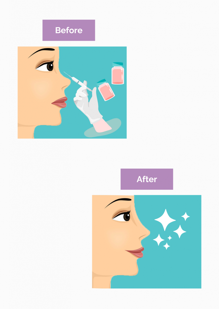 Non surgical nose job General