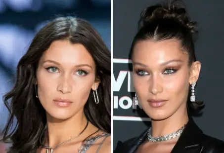 bella hadid plastic surgery