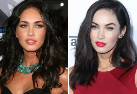 megan fox plastic surgery