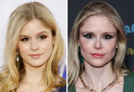 erin moriarty plastic surgery