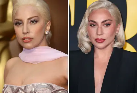 lady gaga plastic surgery (2)