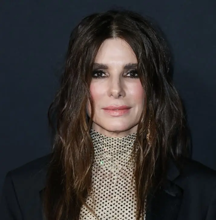 sandra bullock botox