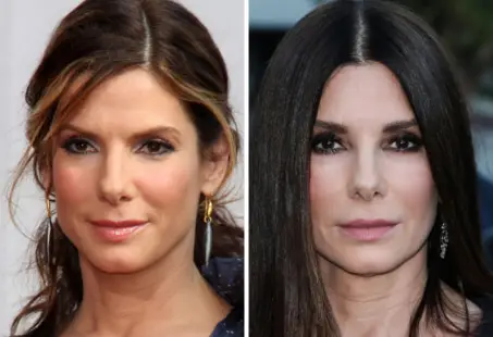 sandra bullock cheek