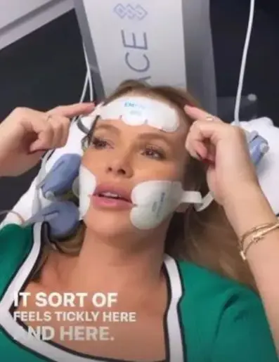 Amanda holden non surgical facelift