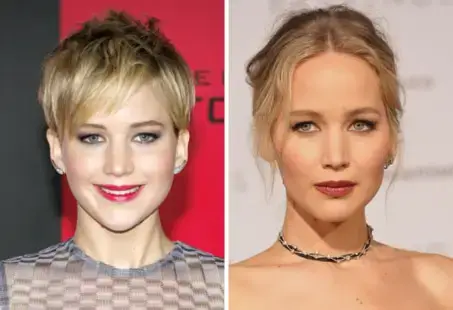 jennifer lawrence plastic surgery