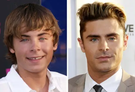 Zac Efron before and after