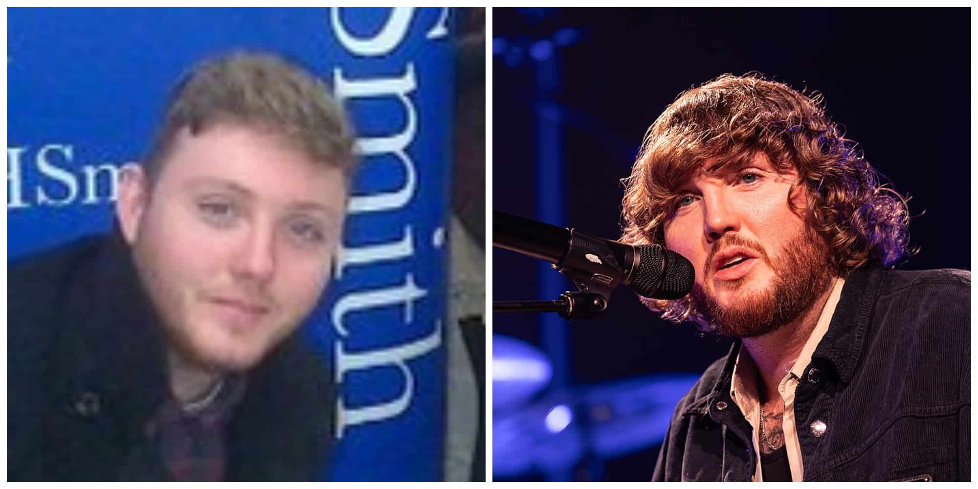 James Arthur Plastic Surgery: Is It True? | Longevita