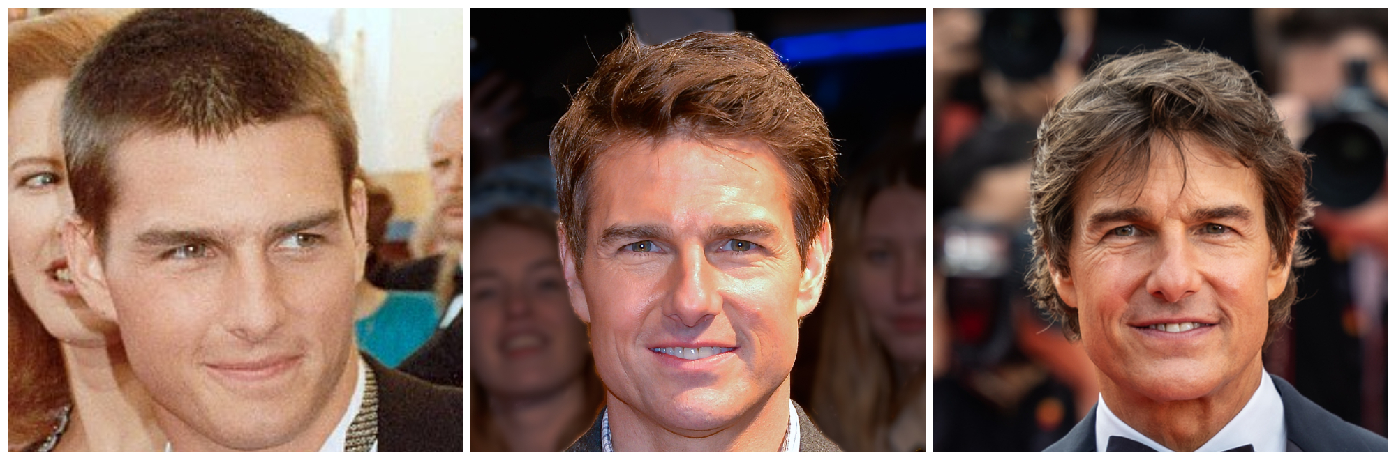 Tom Cruise Plastic Surgery: Did It Happen? | Longevita