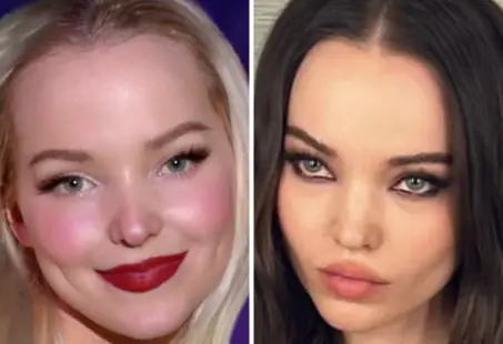 rumours of dove cameron plastic surgery