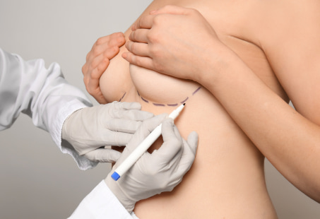 breast drains after surgery