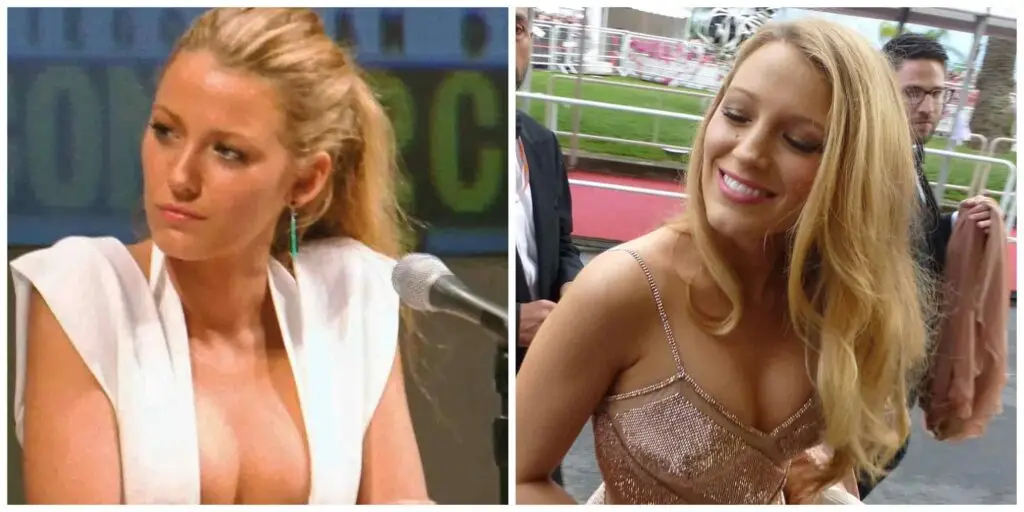 Blake lively nose before and after