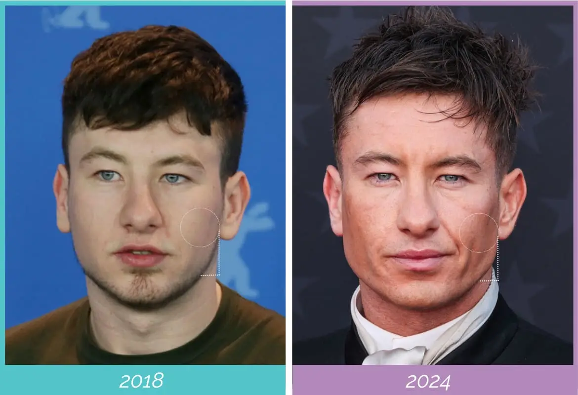 Barry Keoghan 2018 vs 2024