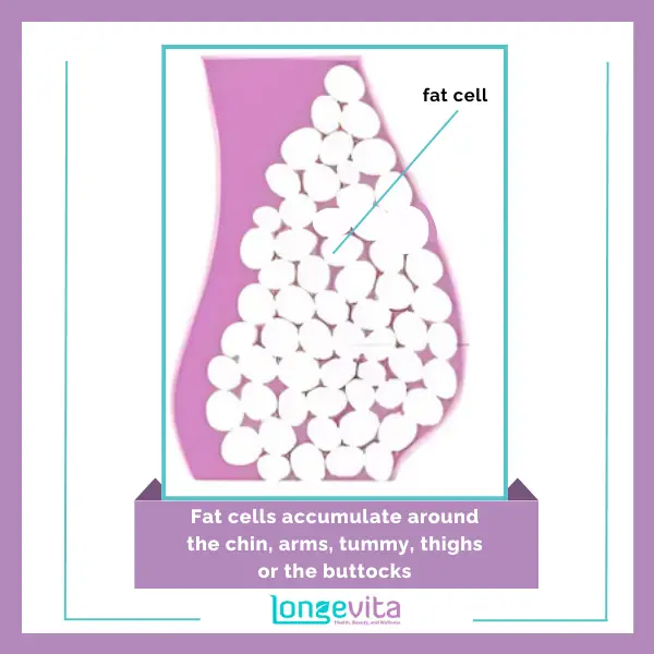 Fat cells accumulate around the chin, arms, tummy, thighs or the buttocks