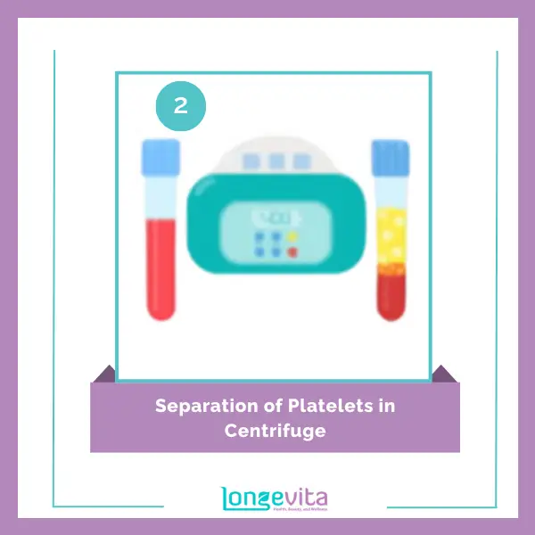 prp separation of platelets