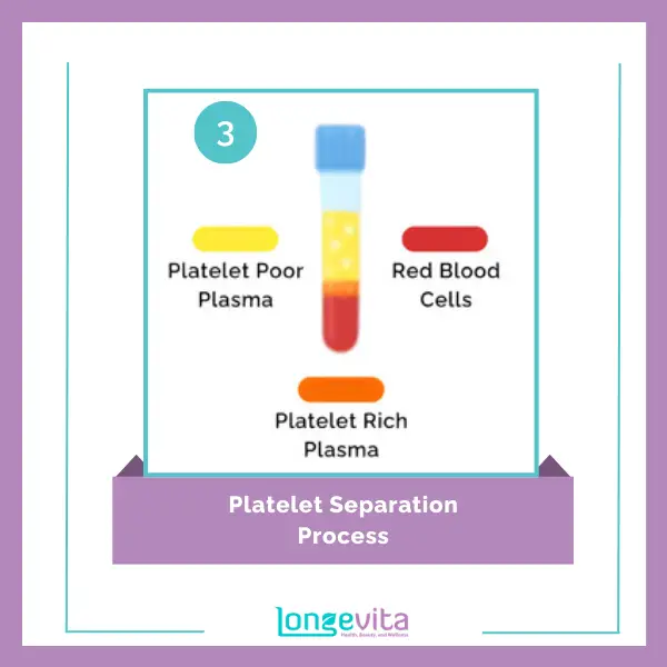 Platelet Separation Process