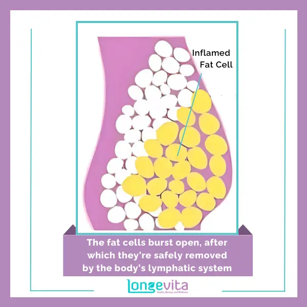 The fat cells burst open, after which they’re safely removed by the body’s lymphatic system